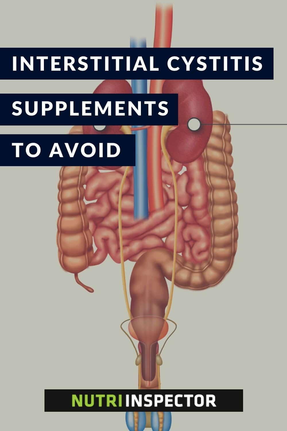 Supplements You Should Avoid for Interstitial Cystitis Nutri Inspector