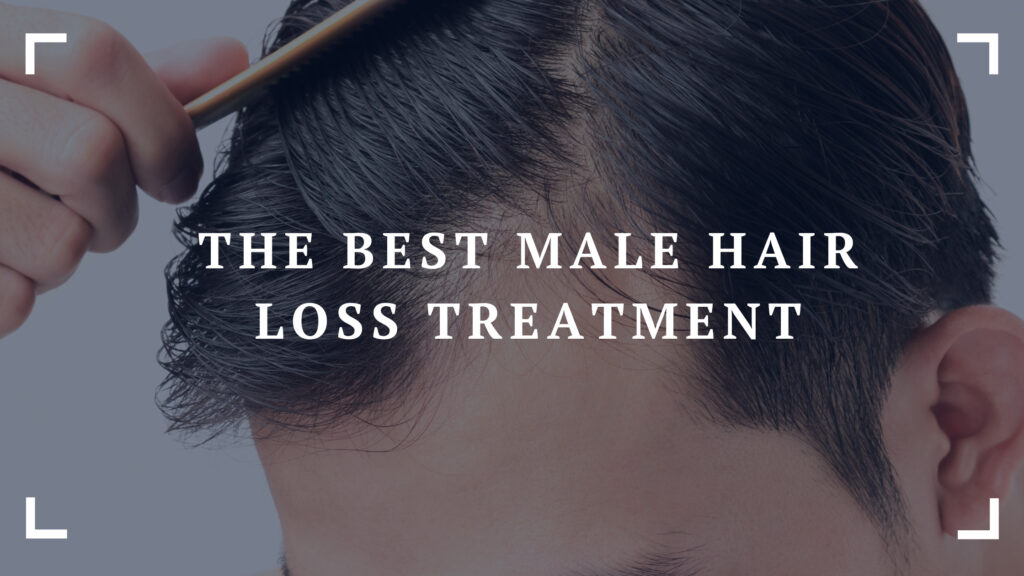 the best male hair loss treatment