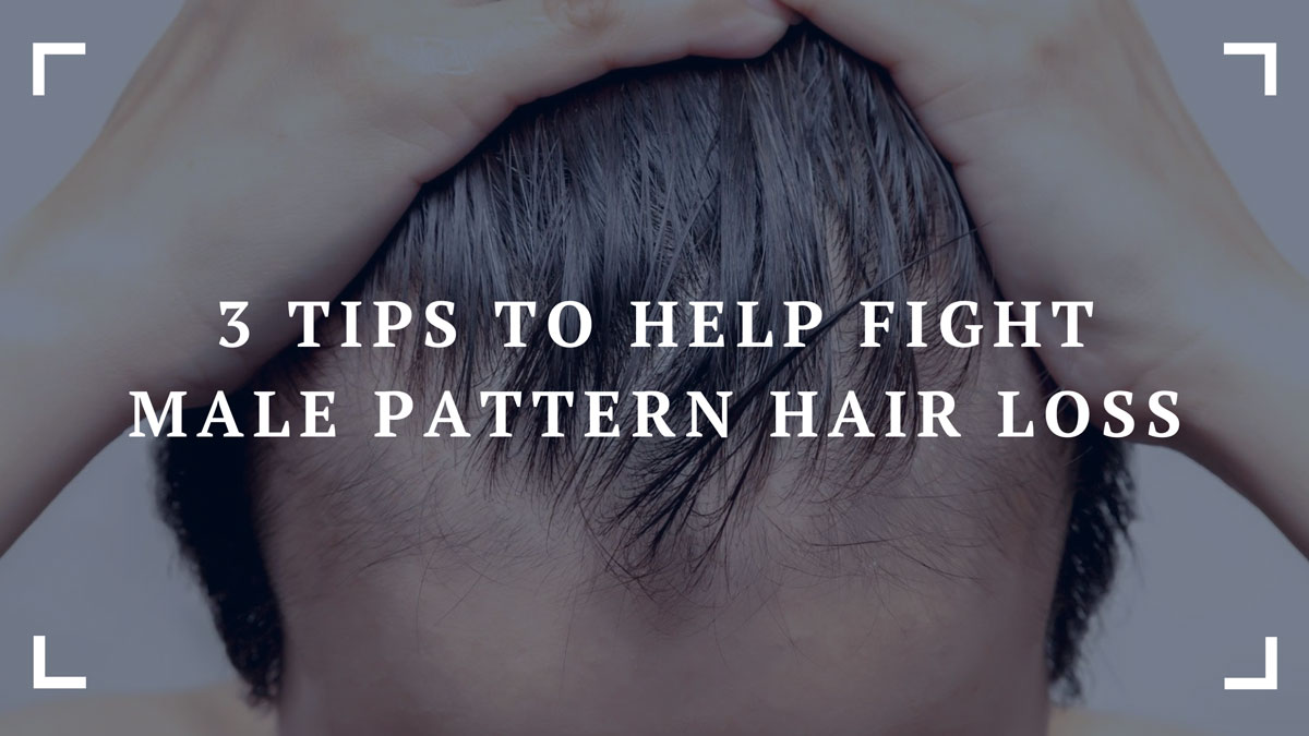 3 tips to help fight male pattern hair loss
