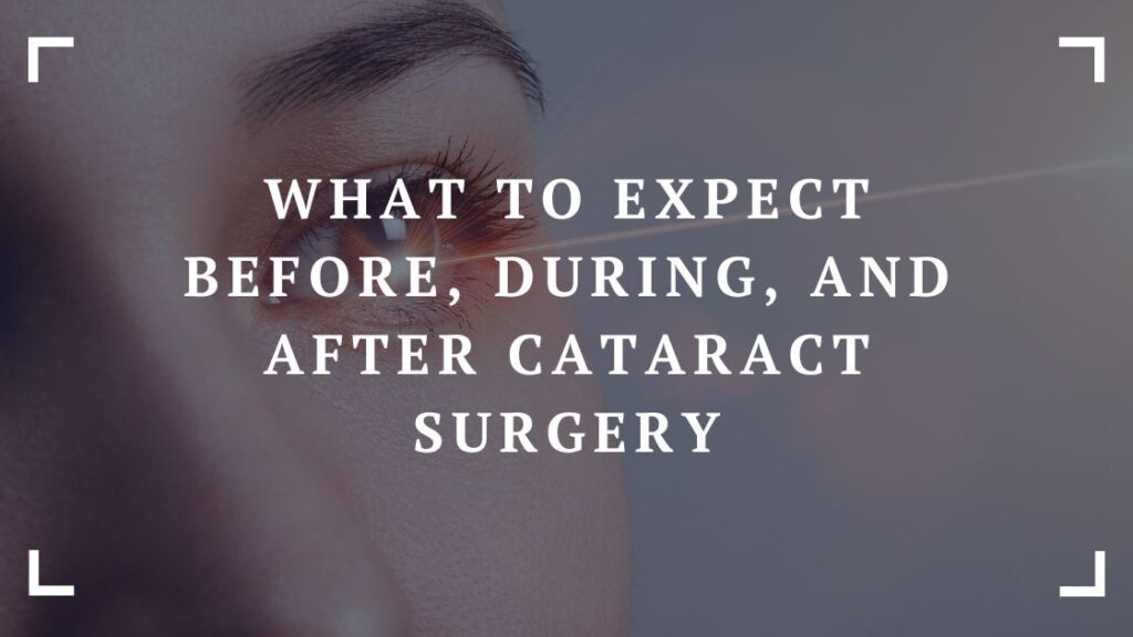 what to expect before during and after cataract surgery