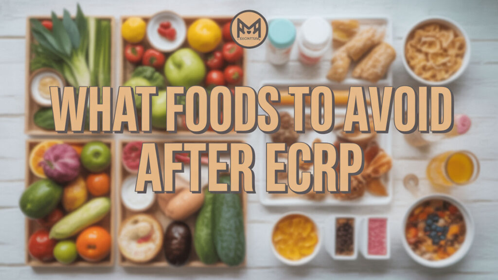 what foods to avoid after ecrp